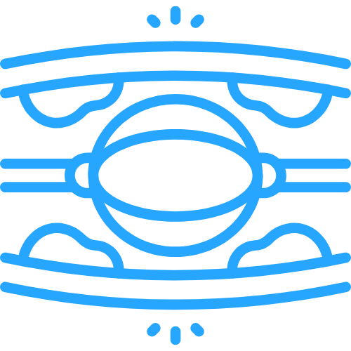 Angioplasty & Stent Placement